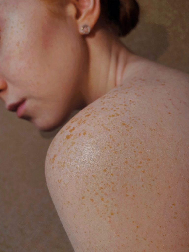 Radiant Skin Treatments Radiant Skin Treatments